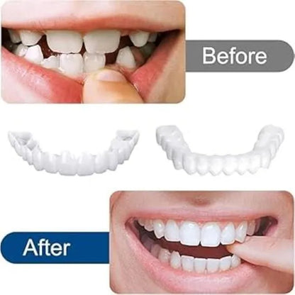 Snap On Fake Teeth Set Brightening Reusable Travel Friendly