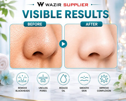Black Head Remover Vacuum